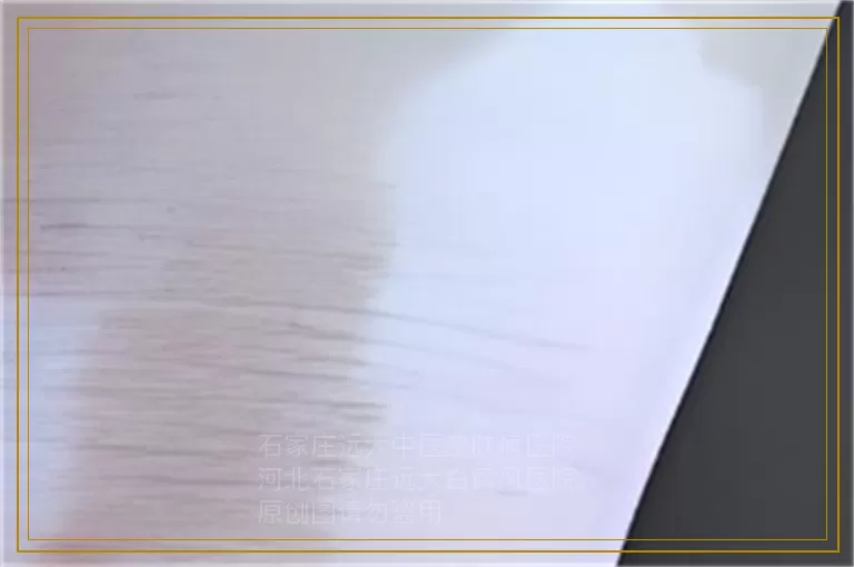 新的儿童白癜风治疗方法是什么呢?