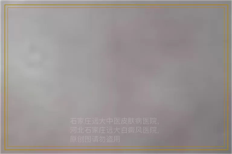 孩子得了白癜风能治好吗