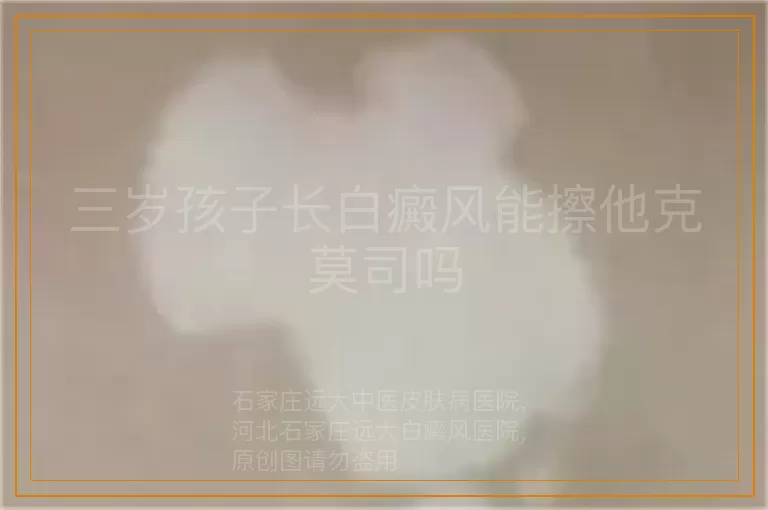 三岁孩子长白癜风能擦他克莫司吗
