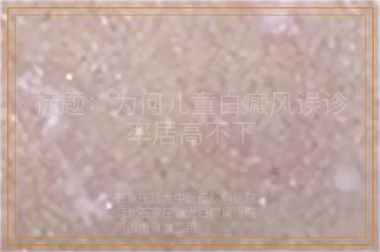 标题：为何儿童白癜风误诊率居高不下