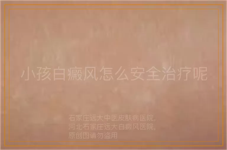 小孩白癜风怎么安全治疗呢