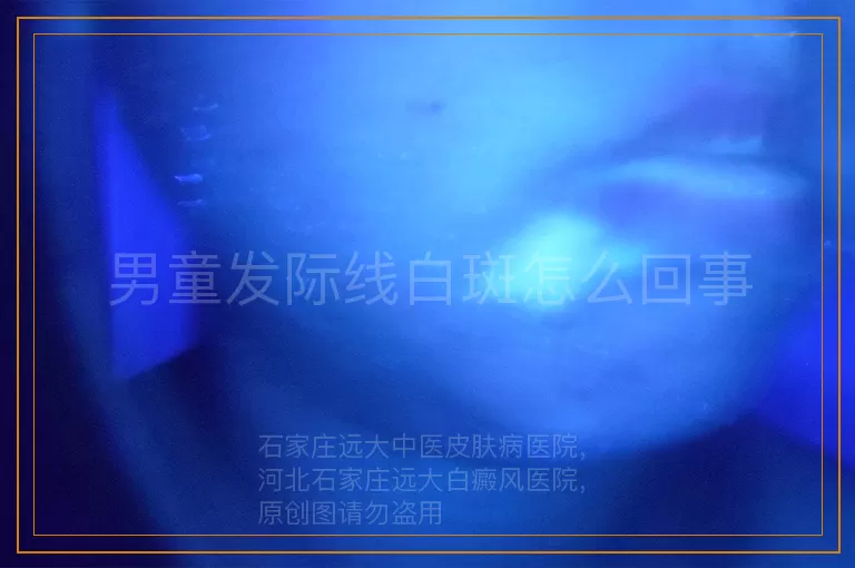 男童发际线白斑怎么回事