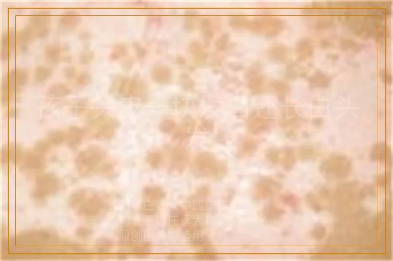 孩子头皮一块发白还长白头发