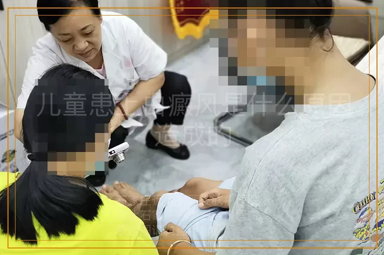 儿童患上白癜风是什么原因造成的