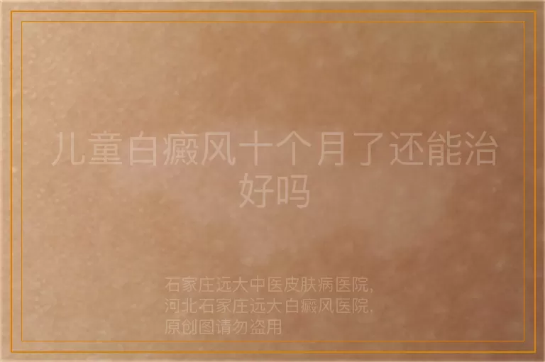 儿童白癜风十个月了还能治好吗