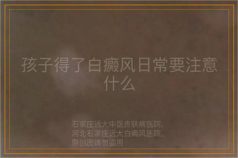 孩子得了白癜风日常要注意什么