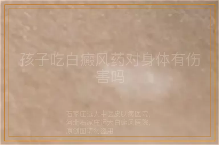 孩子吃白癜风药对身体有伤害吗