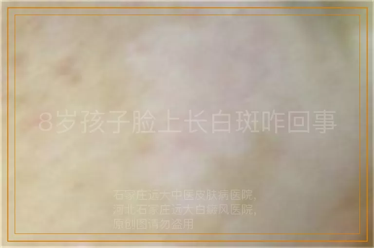8岁孩子脸上长白斑咋回事