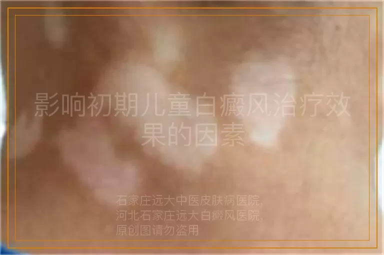 影响初期儿童白癜风治疗效果的因素