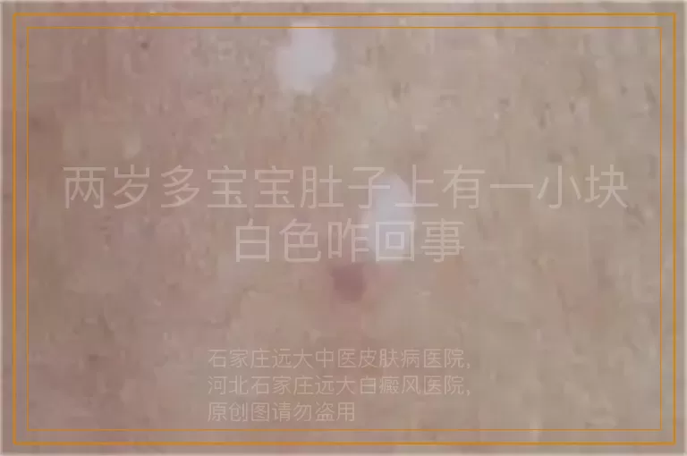 两岁多宝宝肚子上有一小块白色咋回事