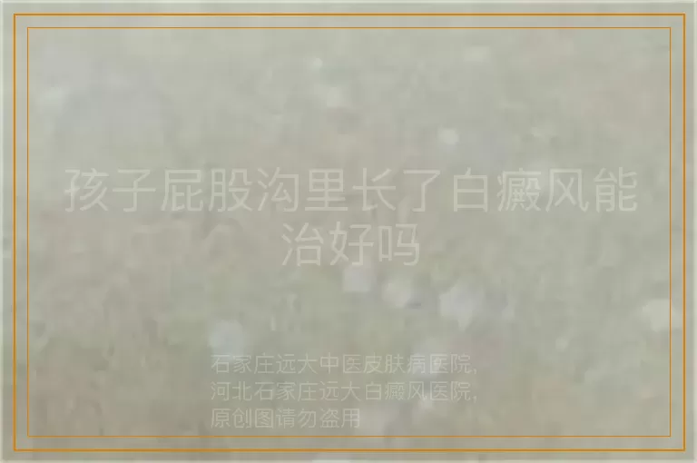 孩子屁股沟里长了白癜风能治好吗