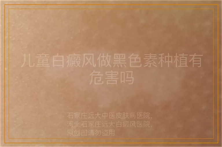 儿童白癜风做黑色素种植有危害吗