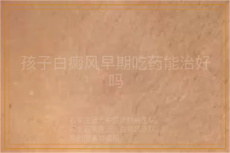 孩子白癜风早期吃药能治好吗