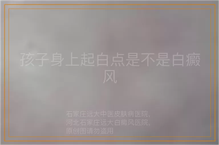 孩子身上起白点是不是白癜风