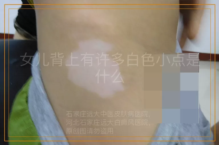 女儿背上有许多白色小点是什么