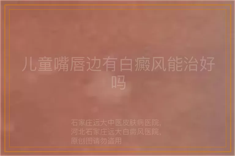 儿童嘴唇边有白癜风能治好吗