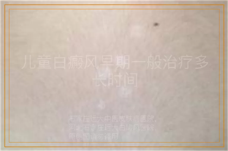 儿童白癜风早期一般治疗多长时间