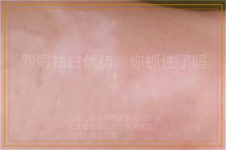 寒假祛白优势，你抓住了吗!