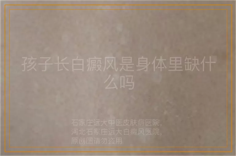 孩子长白癜风是身体里缺什么吗