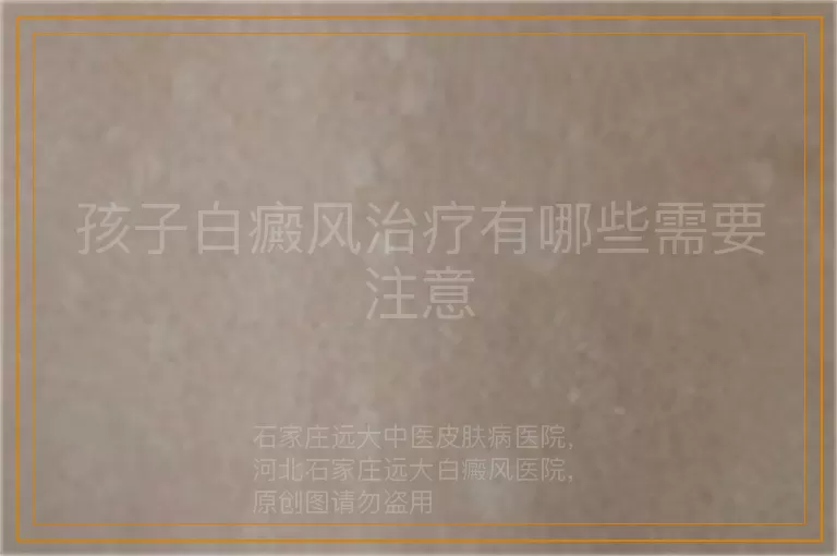 孩子白癜风治疗有哪些需要注意