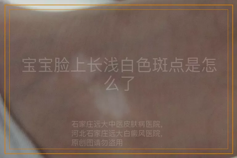 宝宝脸上长浅白色斑点是怎么了