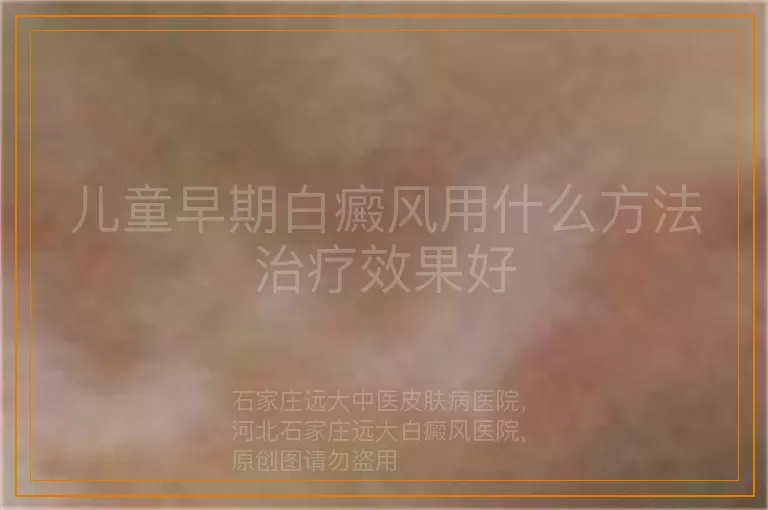 儿童早期白癜风用什么方法治疗效果好