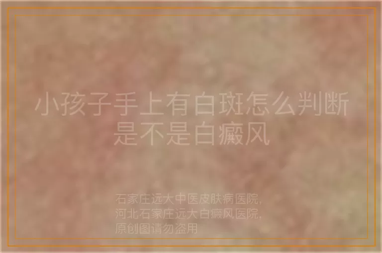 小孩子手上有白斑怎么判断是不是白癜风