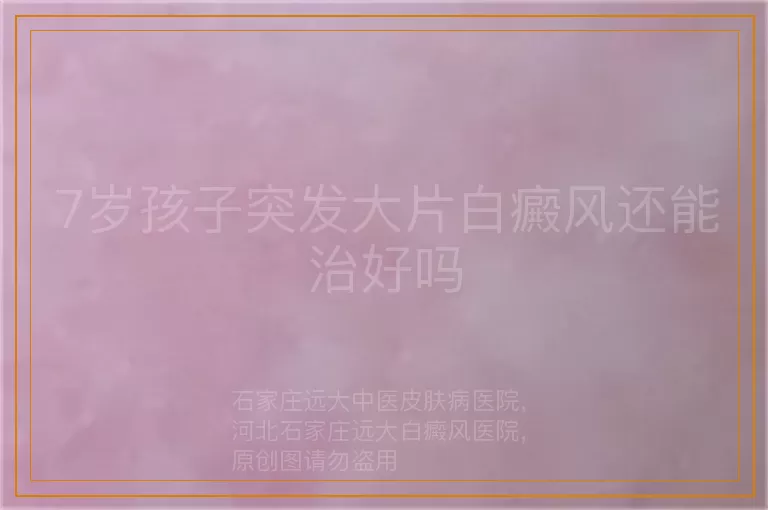 7岁孩子突发大片白癜风还能治好吗
