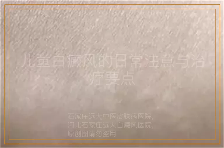 儿童白癜风的日常注意与治疗要点