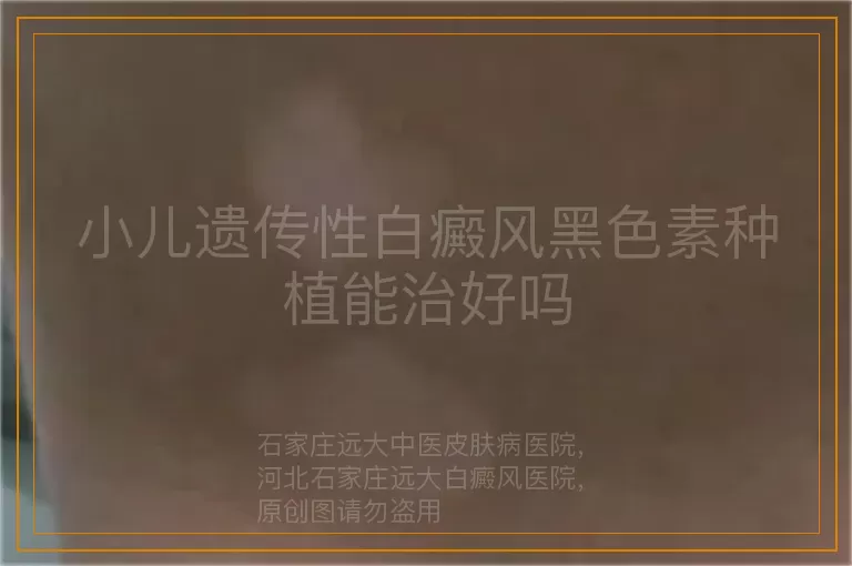 小儿遗传性白癜风黑色素种植能治好吗