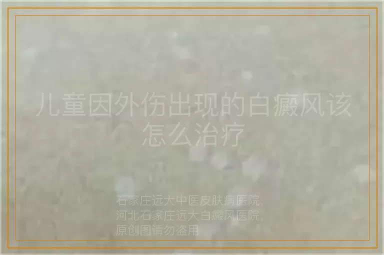 儿童因外伤出现的白癜风该怎么治疗