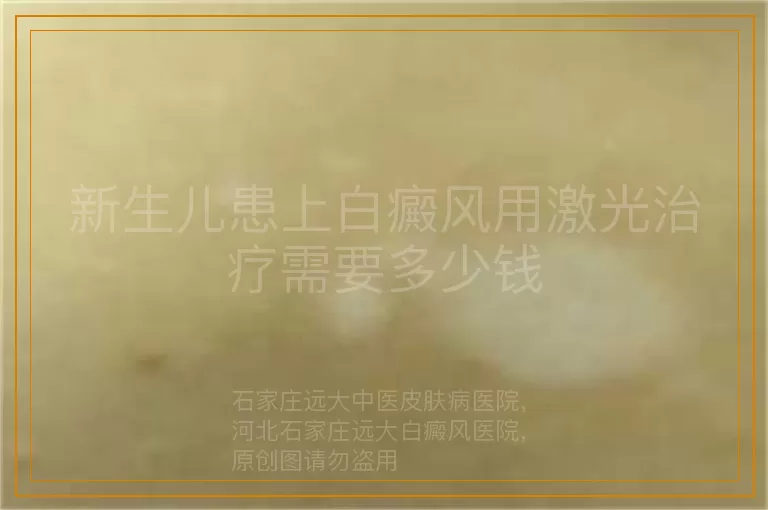新生儿患上白癜风用激光治疗需要多少钱