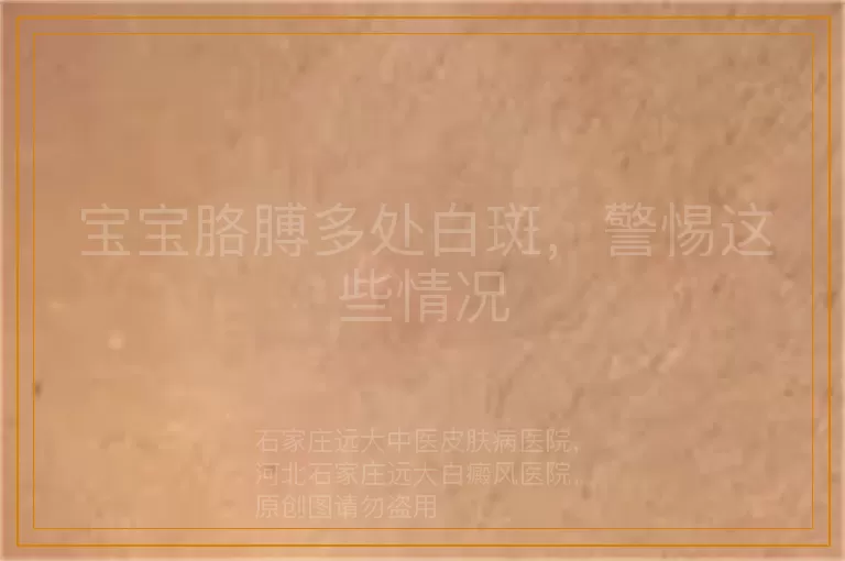 宝宝胳膊多处白斑，警惕这些情况