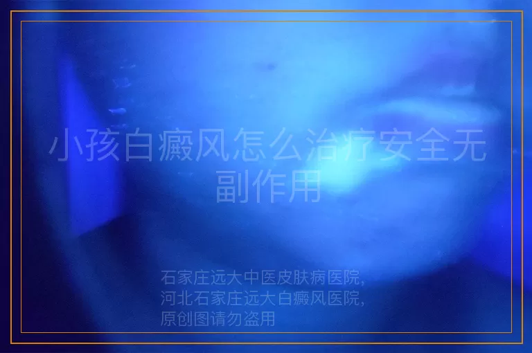 小孩白癜风怎么治疗安全无副作用