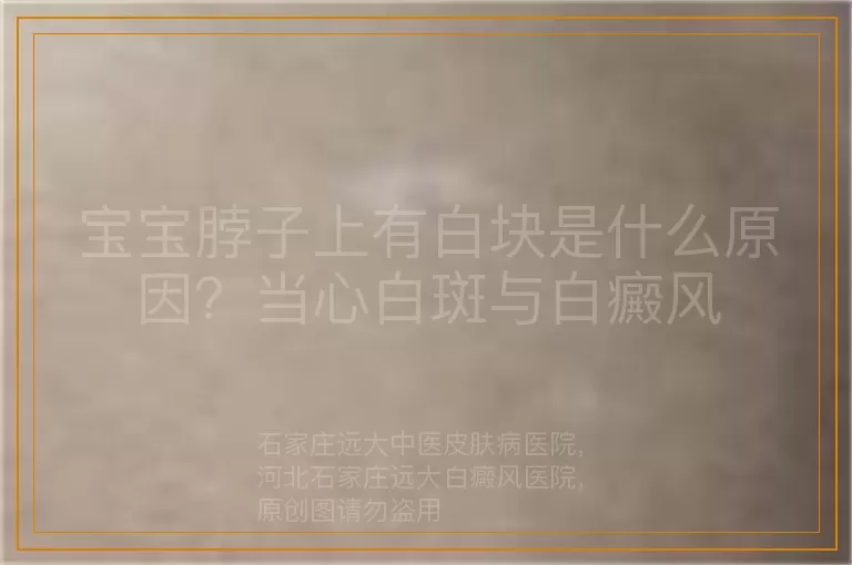 宝宝脖子上有白块是什么原因？当心白斑与白癜风