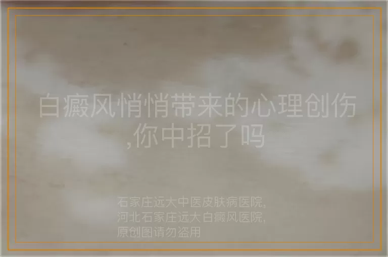 白癜风悄悄带来的心理创伤,你中招了吗