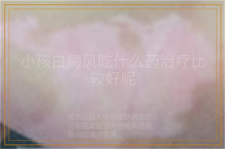 小孩白癜风吃什么药治疗比较好呢