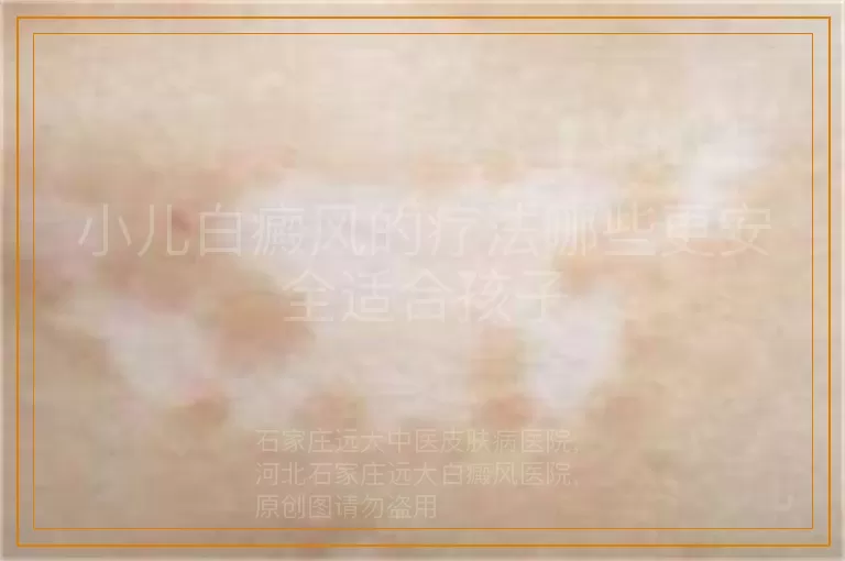 小儿白癜风的疗法哪些更安全适合孩子