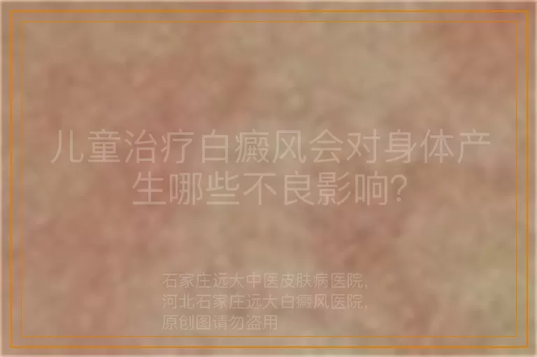 儿童治疗白癜风会对身体产生哪些不良影响？