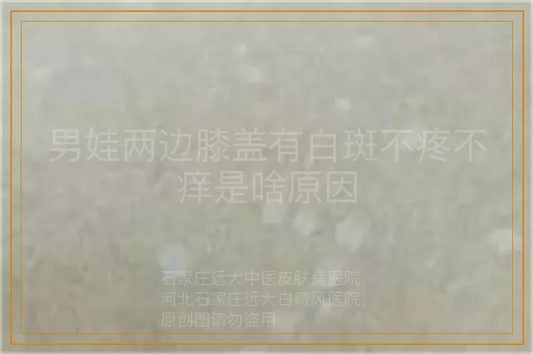 男娃两边膝盖有白斑不疼不痒是啥原因