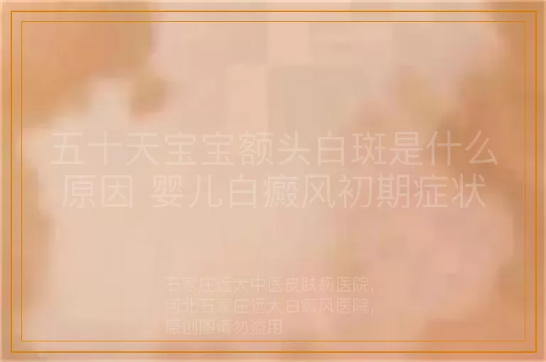 五十天宝宝额头白斑是什么原因 婴儿白癜风初期症状