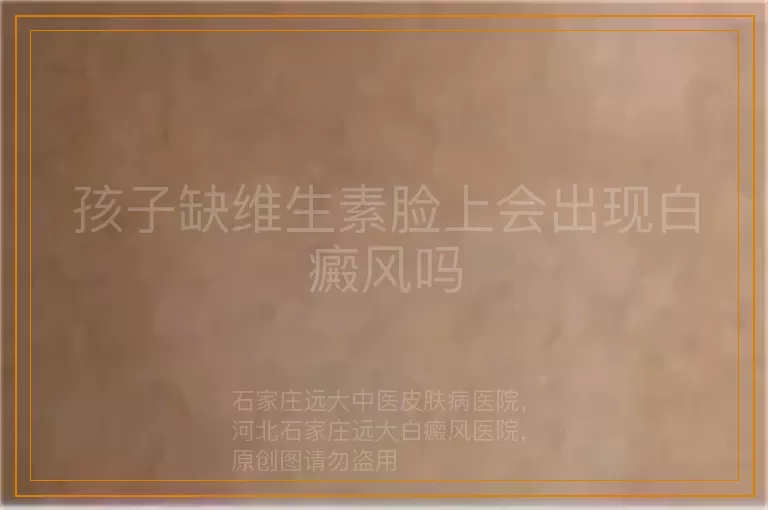 孩子缺维生素脸上会出现白癜风吗