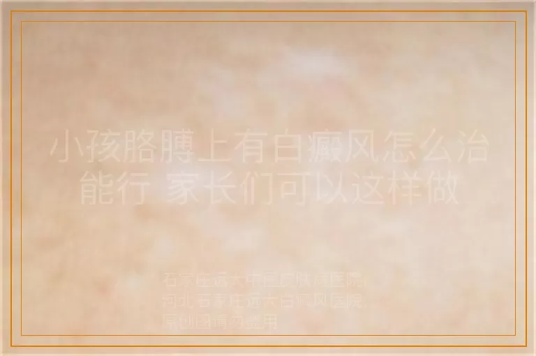 小孩胳膊上有白癜风怎么治能行 家长们可以这样做