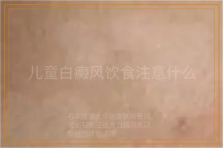 儿童白癜风饮食注意什么