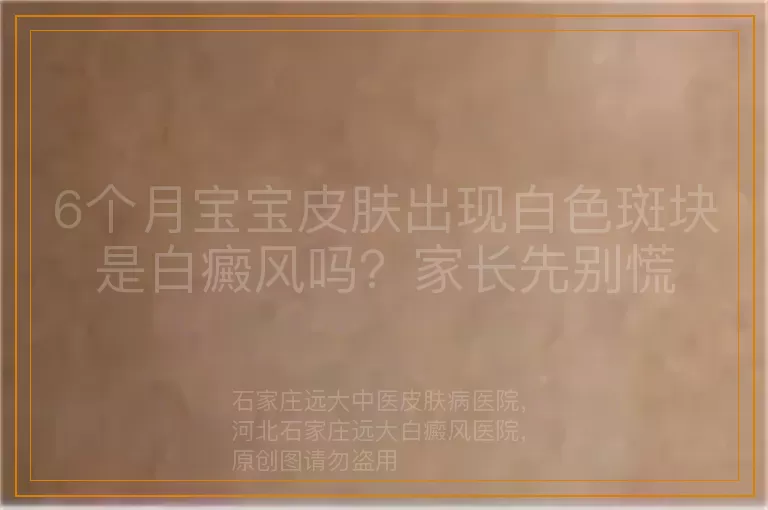 6个月宝宝皮肤出现白色斑块是白癜风吗？家长先别慌