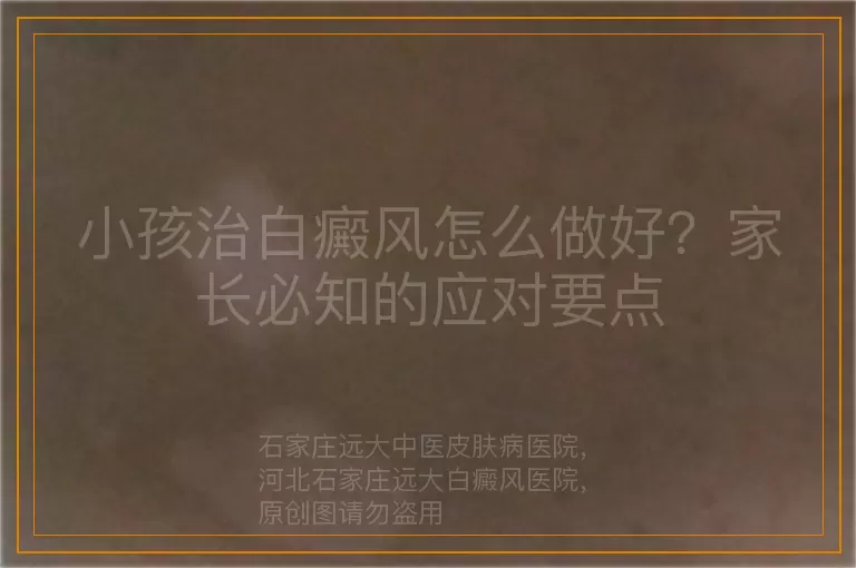 小孩治白癜风怎么做好？家长必知的应对要点