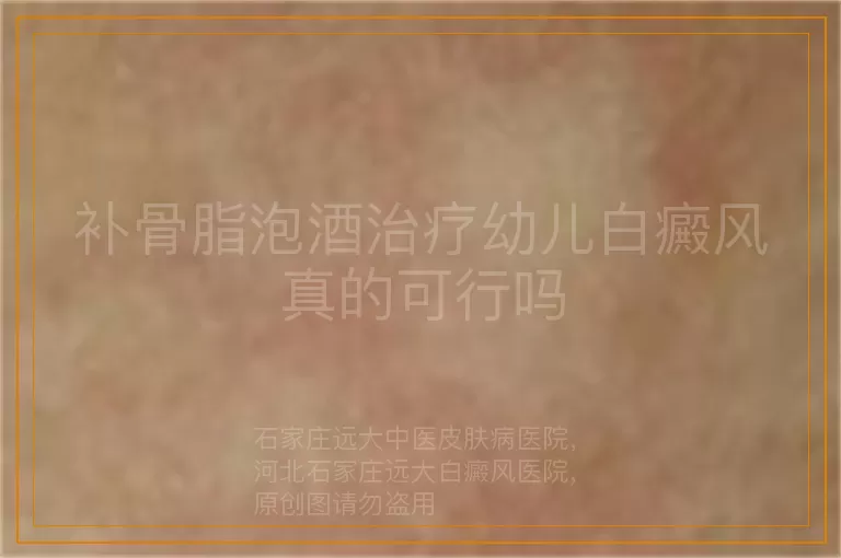 补骨脂泡酒治疗幼儿白癜风真的可行吗