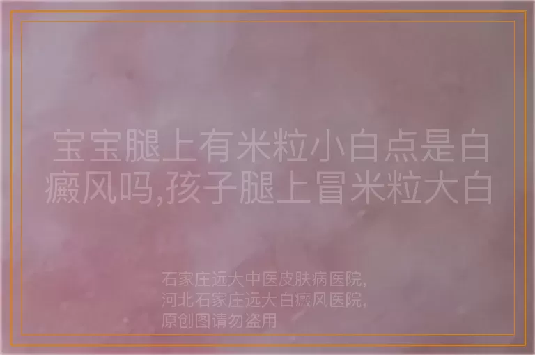 宝宝腿上有米粒小白点是白癜风吗,孩子腿上冒米粒大白斑警惕白癜风,宝宝腿现米粒大小白点或是白癜风