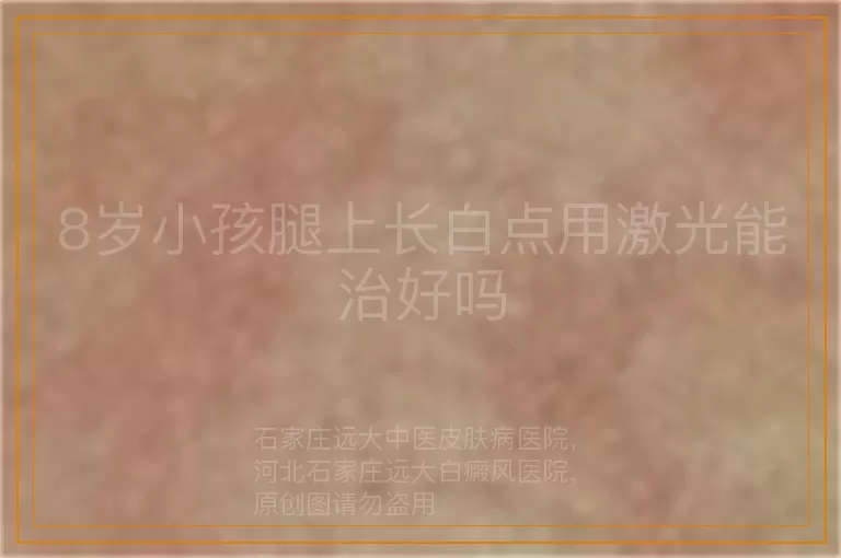 8岁小孩腿上长白点用激光能治好吗
