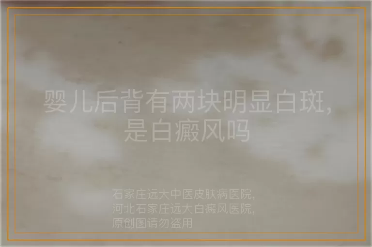 婴儿后背有两块明显白斑，是白癜风吗